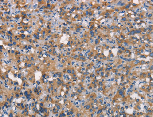 CD66c / CEACAM6 Antibody - Immunohistochemistry of paraffin-embedded Human brain using CEACAM6 Polyclonal Antibody at dilution of 1:70.