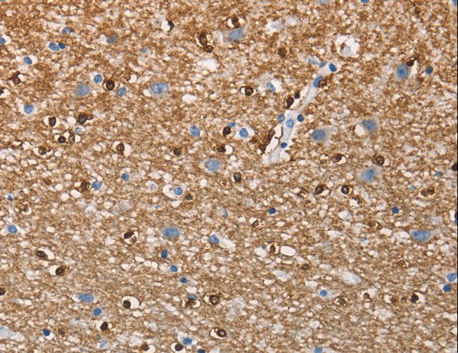 CD66c / CEACAM6 Antibody - Immunohistochemistry of paraffin-embedded Human brain using CEACAM6 Polyclonal Antibody at dilution of 1:70.