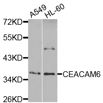 CD66c / CEACAM6 Antibody - Western blot analysis of extracts of various cells.