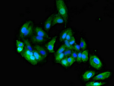 CD66c / CEACAM6 Antibody - Immunofluorescent analysis of HepG2 cells diluted at 1:100 and Alexa Fluor 488-congugated AffiniPure Goat Anti-Rabbit IgG(H+L)