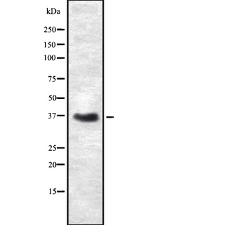 CD66c / CEACAM6 Antibody - Western blot analysis of CEACAM6 using COLO205 whole cells lysates