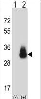CD66d / CEACAM3 Antibody - Western blot of CEACAM3 (arrow) using rabbit polyclonal CEACAM3 Antibody. 293 cell lysates (2 ug/lane) either nontransfected (Lane 1) or transiently transfected (Lane 2) with the CEACAM3 gene.