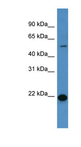 CD66d / CEACAM3 Antibody - CEACAM3 antibody Western blot of Fetal Liver lysate.  This image was taken for the unconjugated form of this product. Other forms have not been tested.