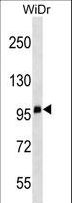 CD68 Antibody - CD68 Antibody western blot of WiDr cell line lysates (35 ug/lane). The CD68/CD68 (kpi) antibody detected the CD68/CD68 (kpi) protein (arrow).