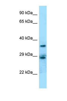 CD68 Antibody - CD68 antibody Western blot of Jurkat Cell lysate. Antibody concentration 1 ug/ml.  This image was taken for the unconjugated form of this product. Other forms have not been tested.