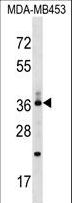 CD68 Antibody - CD68/CD68 (kpi) Antibody western blot of MDA-MB453 cell line lysates (35 ug/lane). The CD68/CD68 (kpi) antibody detected the CD68/CD68 (kpi) protein (arrow).