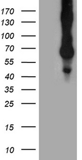 CD68 Antibody - HEK293T cells were transfected with the pCMV6-ENTRY control. (Left lane) or pCMV6-ENTRY CD68. (Right lane) cDNA for 48 hrs and lysed. Equivalent amounts of cell lysates. (5 ug per lane) were separated by SDS-PAGE and immunoblotted with anti-CD68. (1:2000)