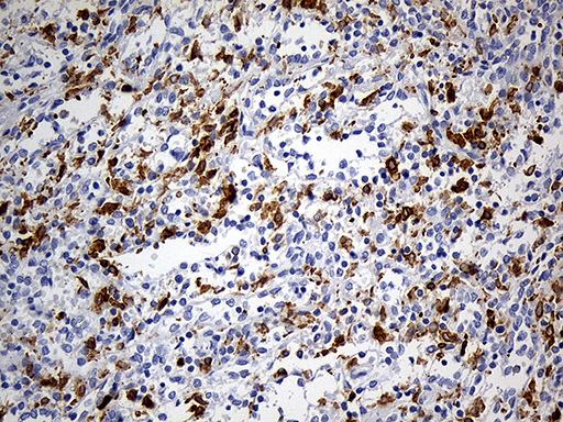 CD68 Antibody - Immunohistochemical staining of paraffin-embedded Human lymph node tissue within the normal limits using anti-CD68 mouse monoclonal antibody. (Heat-induced epitope retrieval by 1mM EDTA in 10mM Tris buffer. (pH8.5) at 120°C for 3 min. (1:500)