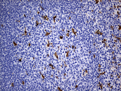 CD68 Antibody - Immunohistochemical staining of paraffin-embedded Human tonsil within the normal limits using anti-CD68 mouse monoclonal antibody. (Heat-induced epitope retrieval by 1mM EDTA in 10mM Tris buffer. (pH8.5) at 120°C for 3 min. (1:500)