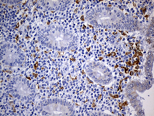 CD68 Antibody - Immunohistochemical staining of paraffin-embedded Human appendix tissue within the normal limits using anti-CD68 mouse monoclonal antibody. (Heat-induced epitope retrieval by 1mM EDTA in 10mM Tris buffer. (pH8.5) at 120°C for 3 min. (1:500)