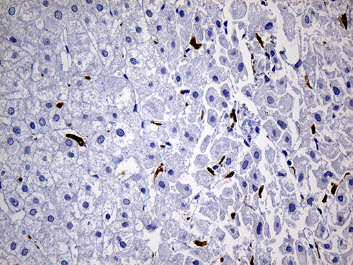 CD68 Antibody - Immunohistochemical staining of paraffin-embedded Human liver tissue within the normal limits using anti-CD68 mouse monoclonal antibody. (Heat-induced epitope retrieval by 1mM EDTA in 10mM Tris buffer. (pH8.5) at 120°C for 3 min. (1:500)