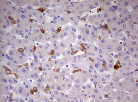 CD68 Antibody - IHC of paraffin-embedded Human liver tissue using anti-CD68 mouse monoclonal antibody. (Heat-induced epitope retrieval by 10mM citric buffer, pH6.0, 120°C for 3min).