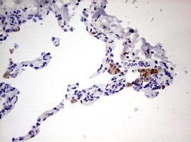 CD68 Antibody - IHC of paraffin-embedded Human lung tissue using anti-CD68 mouse monoclonal antibody. (Heat-induced epitope retrieval by 10mM citric buffer, pH6.0, 120°C for 3min).