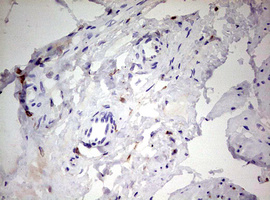 CD68 Antibody - IHC of paraffin-embedded Human bladder tissue using anti-CD68 mouse monoclonal antibody. (Heat-induced epitope retrieval by 10mM citric buffer, pH6.0, 120°C for 3min).