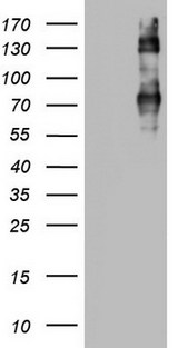 CD68 Antibody - HEK293T cells were transfected with the pCMV6-ENTRY control (Left lane) or pCMV6-ENTRY CD68 (Right lane) cDNA for 48 hrs and lysed. Equivalent amounts of cell lysates (5 ug per lane) were separated by SDS-PAGE and immunoblotted with anti-CD68.