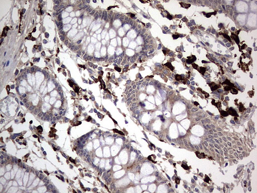 CD68 Antibody - IHC of paraffin-embedded Human colon tissue using anti-CD68 mouse monoclonal antibody. (heat-induced epitope retrieval by 1 mM EDTA in 10mM Tris, pH8.5, 120°C for 3min).