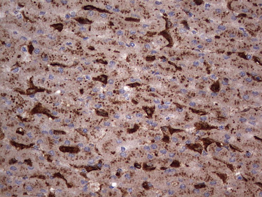 CD68 Antibody - IHC of paraffin-embedded Human liver tissue using anti-CD68 mouse monoclonal antibody. (heat-induced epitope retrieval by 1 mM EDTA in 10mM Tris, pH8.5, 120°C for 3min).