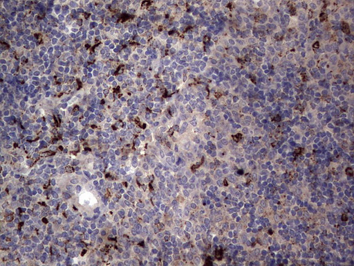 CD68 Antibody - IHC of paraffin-embedded Human tonsil using anti-CD68 mouse monoclonal antibody. (heat-induced epitope retrieval by 1 mM EDTA in 10mM Tris, pH8.5, 120°C for 3min).