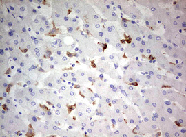 CD68 Antibody - IHC of paraffin-embedded Human liver tissue using anti-CD68 mouse monoclonal antibody. (Heat-induced epitope retrieval by 10mM citric buffer, pH6.0, 120°C for 3min).