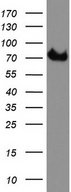 CD68 Antibody - Western blot analysis of COLO205 cell lysate. (35ug) by using anti-CD68 monoclonal antibody. The molecular weight of highly glycosylated CD68 is between 75-110 kDa.