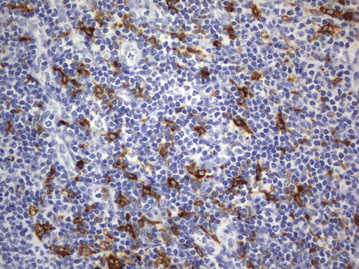CD68 Antibody - Immunohistochemical staining of paraffin-embedded Human lymph node tissue using anti-CD68 mouse monoclonal antibody.  heat-induced epitope retrieval by 10mM citric buffer, pH6.0, 120C for 3min)