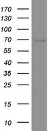 CD68 Antibody - Western blot analysis of A498 cell lysate. (35ug) by using anti-CD68 monoclonal antibody. The molecular weight of highly glycosylated CD68 is between 75-110 kDa.