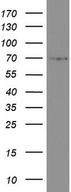 CD68 Antibody - Western blot analysis of MALME3M cell lysate. (35ug) by using anti-CD68 monoclonal antibody. The molecular weight of highly glycosylated CD68 is between 75-110 kDa.