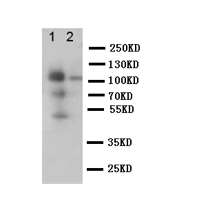 CD68 Antibody - WB of CD68 antibody. Lane 1: Rat Spleen Tissue Lysate. Lane 2: Rat Lung Tissue Lysate.