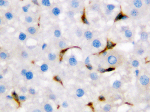 CD68 Antibody - CD68 antibody. IHC(P): Rat Liver Tissue.