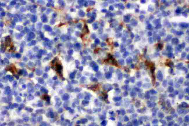 CD68 Antibody - IHC analysis of CD68 using anti-CD68 antibody. CD68 was detected in paraffin-embedded section of Rat Spleen tissues. Heat mediated antigen retrieval was performed in citrate buffer (pH6, epitope retrieval solution) for 20 mins. The tissue section was blocked with 10% goat serum. The tissue section was then incubated with 1µg/ml rabbit anti-CD68 Antibody overnight at 4°C. Biotinylated goat anti-rabbit IgG was used as secondary antibody and incubated for 30 minutes at 37°C. The tissue section was developed using Strepavidin-Biotin-Complex (SABC) with DAB as the chromogen.