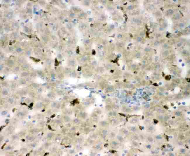 CD68 Antibody - IHC analysis of CD68 using anti-CD68 antibody. CD68 was detected in paraffin-embedded section of Mouse Liver tissues. Heat mediated antigen retrieval was performed in citrate buffer (pH6, epitope retrieval solution) for 20 mins. The tissue section was blocked with 10% goat serum. The tissue section was then incubated with 1µg/ml rabbit anti-CD68 Antibody overnight at 4°C. Biotinylated goat anti-rabbit IgG was used as secondary antibody and incubated for 30 minutes at 37°C. The tissue section was developed using Strepavidin-Biotin-Complex (SABC) with DAB as the chromogen.