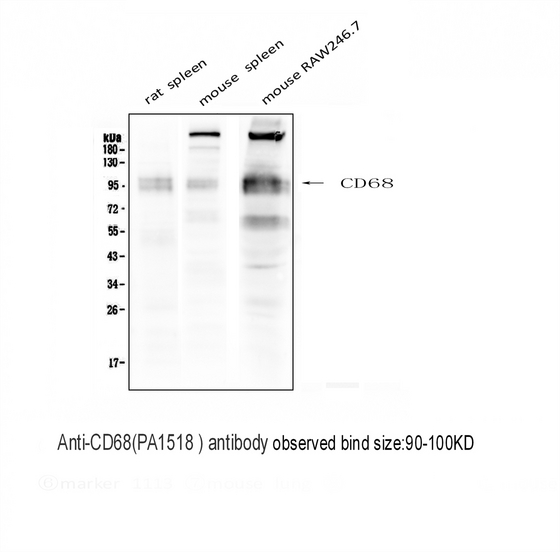 CD68 Antibody - Western blot analysis of CD68 using anti-CD68 antibody. Electrophoresis was performed on a 5-20% SDS-PAGE gel at 70V (Stacking gel) / 90V (Resolving gel) for 2-3 hours. The sample well of each lane was loaded with 50ug of sample under reducing conditions. Lane 1: Rat Spleen Tissue Lysate Lane 2: Mouse Spleen Tissue Lysate Lane 3: Mouse RAW246. 7 Tissue Lysate After Electrophoresis, proteins were transferred to a Nitrocellulose membrane at 150mA for 50-90 minutes. Blocked the membrane with 5% Non-fat Milk/ TBS for 1.5 hour at RT. The membrane was incubated with rabbit anti-CD68 antigen affinity purified polyclonal antibody at 0.5 µg/mL overnight at 4°C, then washed with TBS-0.1% Tween 3 times with 5 minutes each and probed with a goat anti-rabbit IgG-HRP secondary antibody at a dilution of 1:10000 for 1.5 hour at RT. The signal is developed using an Enhanced Chemiluminescent detection (ECL) kit with Tanon 5200 system.