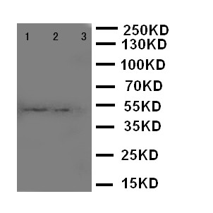 CD68 Antibody - WB of CD68 antibody. Recombinant Protein Detection Source:. E.coli derived -recombinant Human CD68, 42.5KD. (162aa tag+ T128-L354). Lane 1: Recombinant Human CD68 Protein 10ng. Lane 2: Recombinant Human CD68 Protein 5ng. Lane 3: Recombinant Human CD68 Protein 2.5ng.