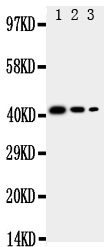 CD68 Antibody - Anti-CD68 antibody, Western blottingRecombinant Protein Detection Source: E. coli derived -recombinant Human CD68, 42. 5KD (162aa tag+ T128-L354)Lane 1: Recombinant Human CD68 Protein 10ng Lane 2: Recombinant Human CD68 Protein 5ng Lane 3: Recombinant Human CD68 Protein 2. 5ng