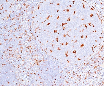 CD68 Antibody - CD68 antibody C68/684 immunohistochemistry tonsil.  This image was taken for the unmodified form of this product. Other forms have not been tested.