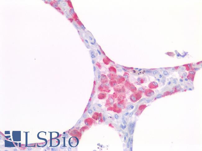 CD68 Antibody - Human Lung: Formalin-Fixed, Paraffin-Embedded (FFPE)