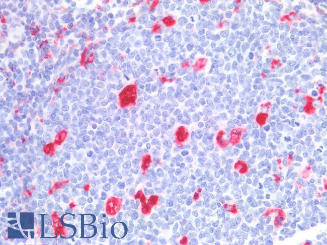 CD68 Antibody - Human Tonsil: Formalin-Fixed, Paraffin-Embedded (FFPE)