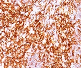 CD68 Antibody - IHC testing of FFPE human tonsil and CD68 antibody (LAM34-1).  This image was taken for the unmodified form of this product. Other forms have not been tested.