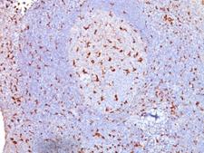 CD68 Antibody - Formalin-fixed, paraffin-embedded human tonsil stained with anti-CD68 antibody (SPM130).  This image was taken for the unmodified form of this product. Other forms have not been tested.