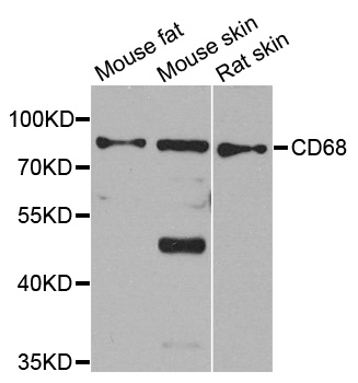 CD68 Antibody - Western blot analysis of extracts of various cell lines.