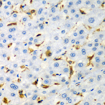 CD68 Antibody - Immunohistochemistry of paraffin-embedded human liver injury tissue.