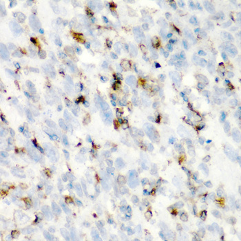 CD68 Antibody - Immunohistochemistry of paraffin-embedded human esophageal cancer tissue.