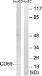 CD69 Antibody - Western blot of extracts from HUVEC cells, using CD69 Antibody. The lane on the right is treated with the synthesized peptide.