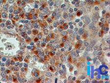 CD69 Antibody - Immunohistochemistry-Paraffin: CD69 Antibody (15B5G2) [Azide Free] - Formalin-fixed, paraffin-embedded human tonsil stained with CD69 antibody (1 ug/ml), peroxidase-conjugate and DAB chromogen. This image was taken for the unmodified form of this product. Other forms have not been tested.