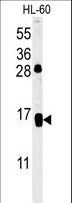 CD69 Antibody - CD69 Antibody western blot of HL-60 cell line lysates (35 ug/lane). The CD69 antibody detected the CD69 protein (arrow).