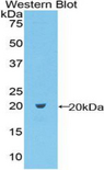 CD69 Antibody - Western blot of recombinant CD69.  This image was taken for the unconjugated form of this product. Other forms have not been tested.