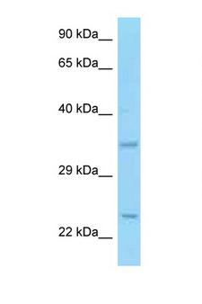 CD69 Antibody - CD69 antibody Western blot of HCT15 Cell lysate. Antibody concentration 1 ug/ml.  This image was taken for the unconjugated form of this product. Other forms have not been tested.