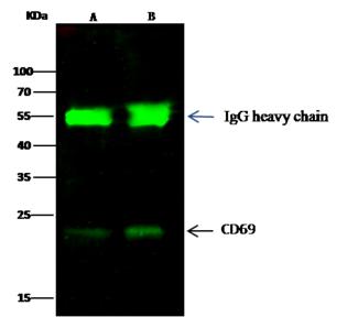 CD69 Antibody - CD69 was immunoprecipitated using: Lane A: 0.5 mg HL-60 Whole Cell Lysate. Lane B: 0.5 mg Jurkat Whole Cell Lysate. 0.5 uL anti-CD69 rabbit monoclonal antibody and 15 ul of 50% Protein G agarose. Primary antibody: Anti-CD69 rabbit monoclonal antibody, at 1:500 dilution. Secondary antibody: Dylight 800-labeled antibody to rabbit IgG (H+L), at 1:5000 dilution. Developed using the odssey technique. Performed under reducing conditions. Predicted band size: 23 kDa. Observed band size: 23 kDa.