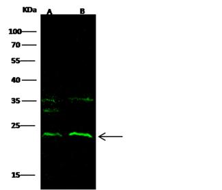 CD69 Antibody - Anti-CD69 rabbit monoclonal antibody at 1:500 dilution. Lane A: Jurkat Whole Cell Lysate. Lane B: HL60 Whole Cell Lysate. Lysates/proteins at 30 ug per lane. Secondary: Goat Anti-Rabbit IgG H&L (Dylight800) at 1/10000 dilution. Developed using the Odyssey technique. Performed under reducing conditions. Predicted band size: 23 kDa. Observed band size: 23 kDa.
