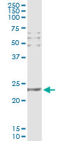 CD69 Antibody - Immunoprecipitation of CD69 transfected lysate using anti-CD69 monoclonal antibody and Protein A Magnetic Bead, and immunoblotted with CD69 rabbit polyclonal antibody.